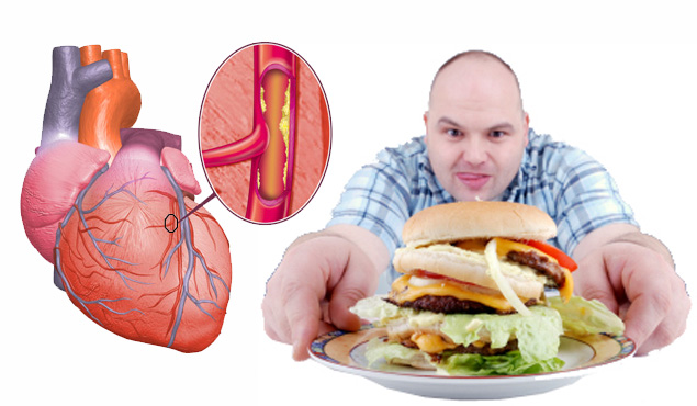 Alimentos malos para el colesterol y trigliceridos