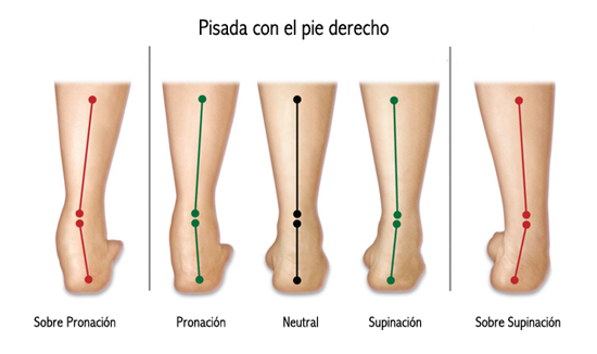 Pie pronador, supinador o neutro