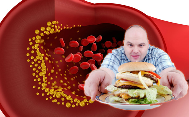 Dieta contra el colesterol