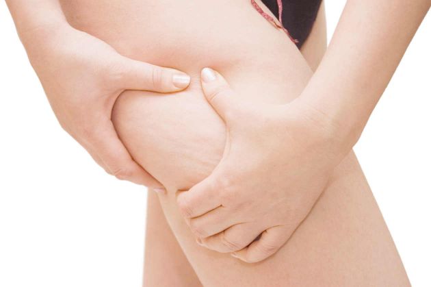 4 Ejercicios para eliminar la celulitis fácilmente