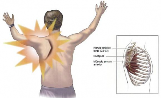 Qué es el músculo serrato anterior