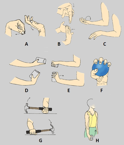 Epicondilitis lateral, ejercicios efectivos